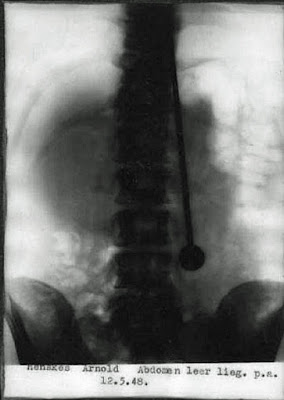 Lustige Kuriose Röntgen Bilder